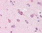 APP / Beta Amyloid Antibody (aa18-289, clone J4H9)